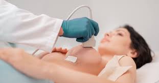 Breast Scan